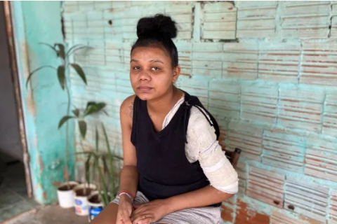 Família de jovem queimada em acidente de moto reivindica transferência do atendimento para Fortaleza